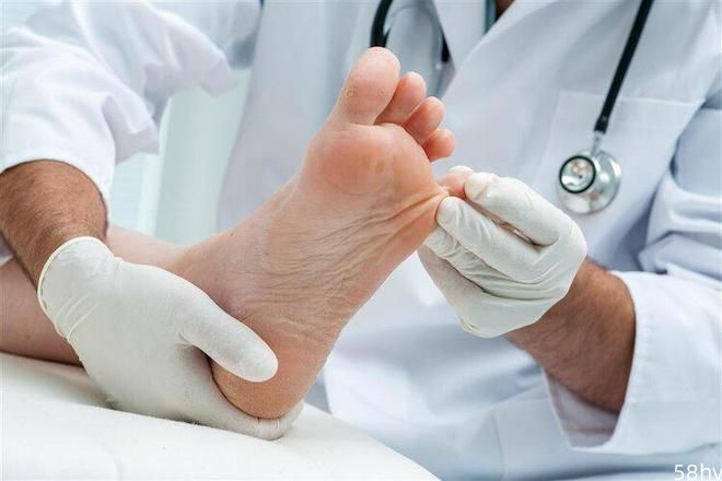 不是脚部衰老，而是疾病信号？脚部出现5种异样，或是身体拉警报