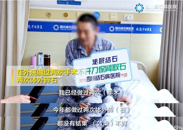 52岁王先生因为肾结石做了三次手术，这是一种什么体验？