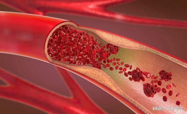 养血管是长寿的关键，有道理吗？