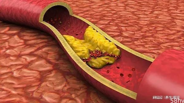 养血管是长寿的关键，有道理吗？