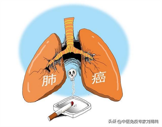 中医：肺癌晚期的治疗，养正积自消！