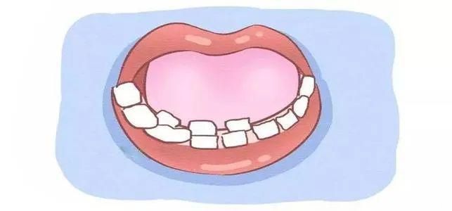 “乳牙滞留”怎么办？口腔医生告诉你！