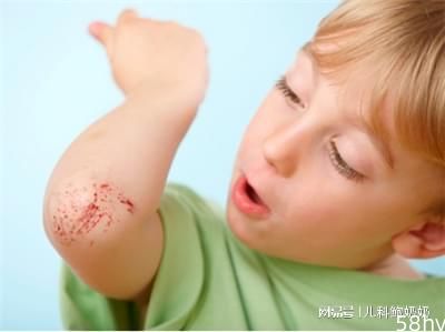 孩子手上有伤口，要注意这件事，严重的可能危及生命！